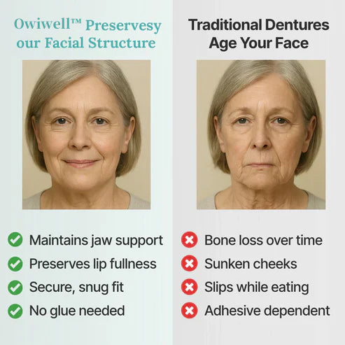 ✨Ends Today: 70% OFF! Owiwell™⏰ Custom-Fit Full Functional Dentures Make you more confident
